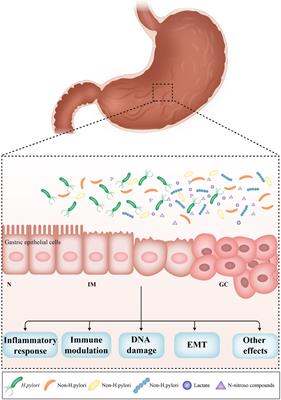 Role of the Gastric Microbiome in Gastric Cancer: From Carcinogenesis to Treatment